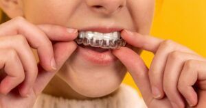 Invisalign in Laurel MD1