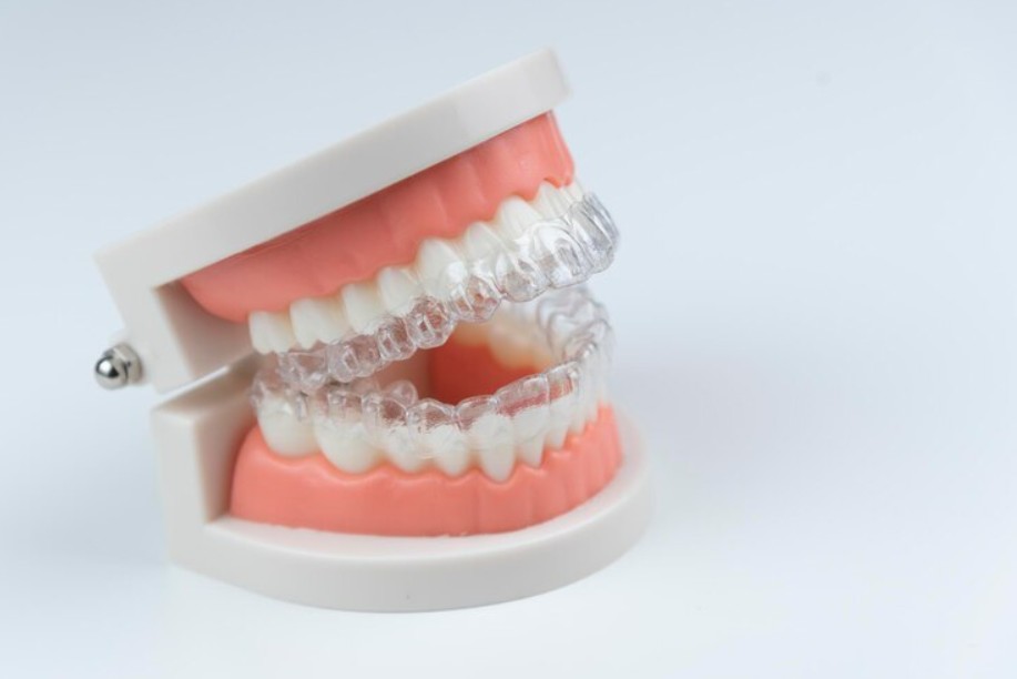 Invisalign in Laurel, MD