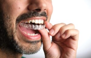 Invisalign in Laurel, MD