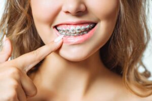 Orthodontics in Laurel MD