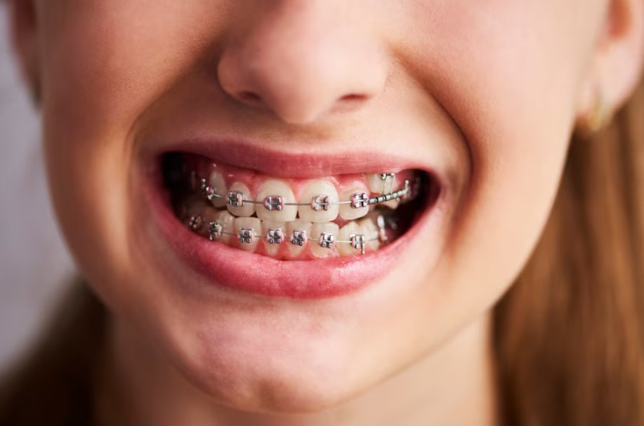 Orthodontics in Laurel, MD
