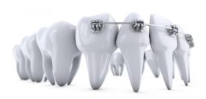 Orthodontics in Laurel, MD