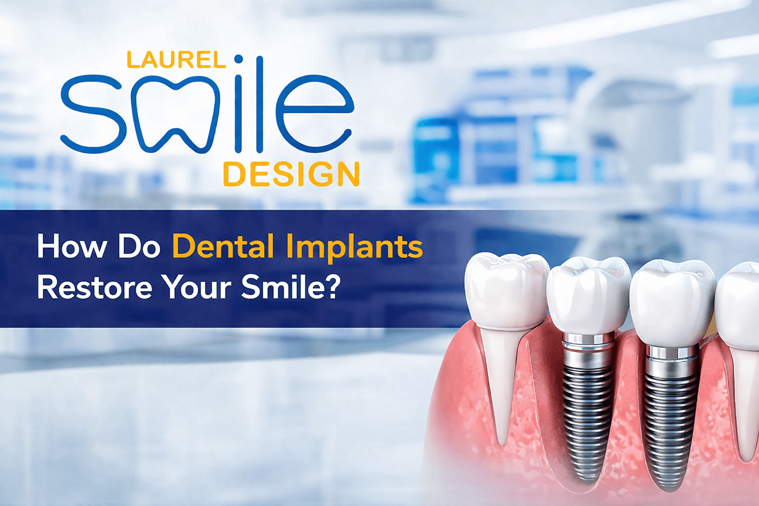 How Do Dental Implants Restore Your Smile? Expert Insights from a Dentist in Laurel MD