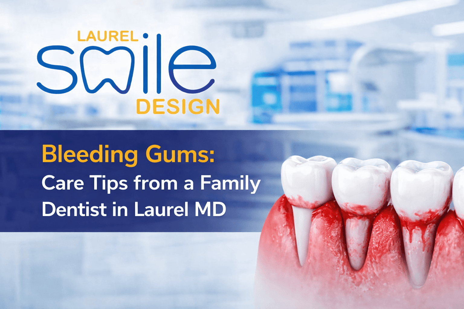 Bleeding Gums: Care Tips from a Family Dentist in Laurel MD