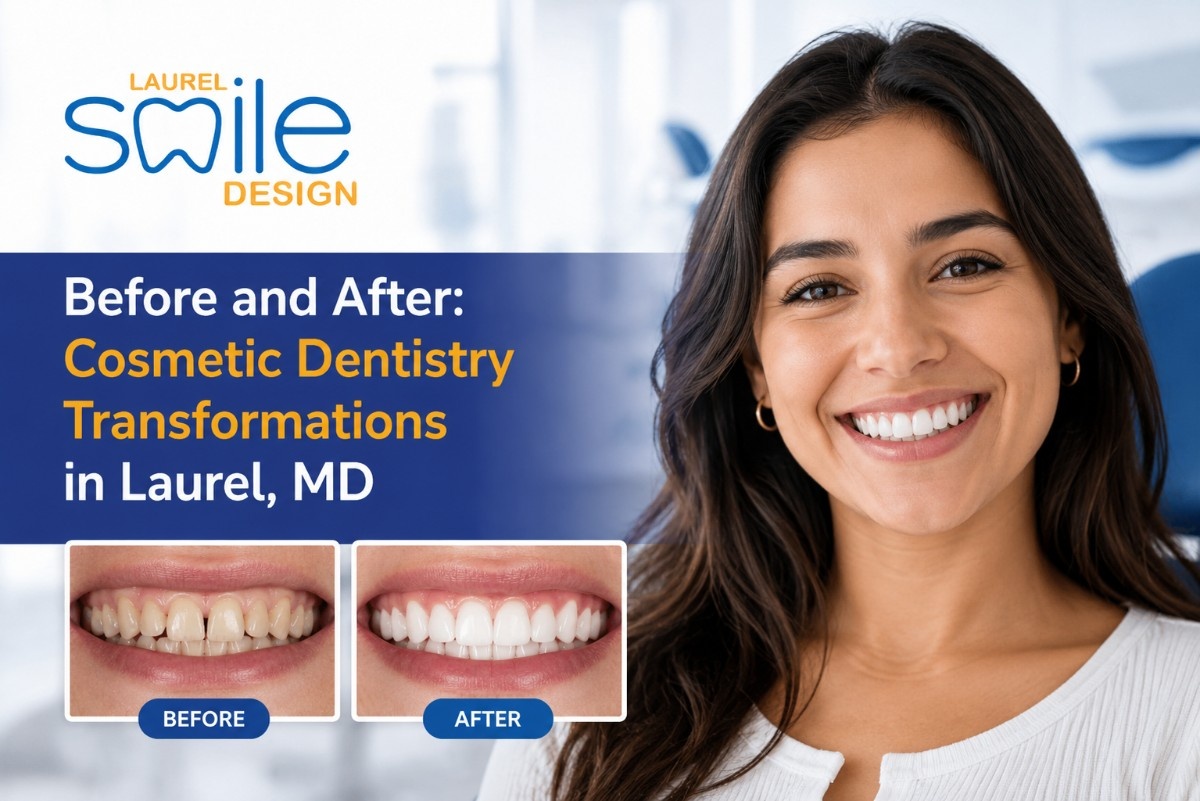 Before and After: Cosmetic Dentistry Transformations in Laurel, MD