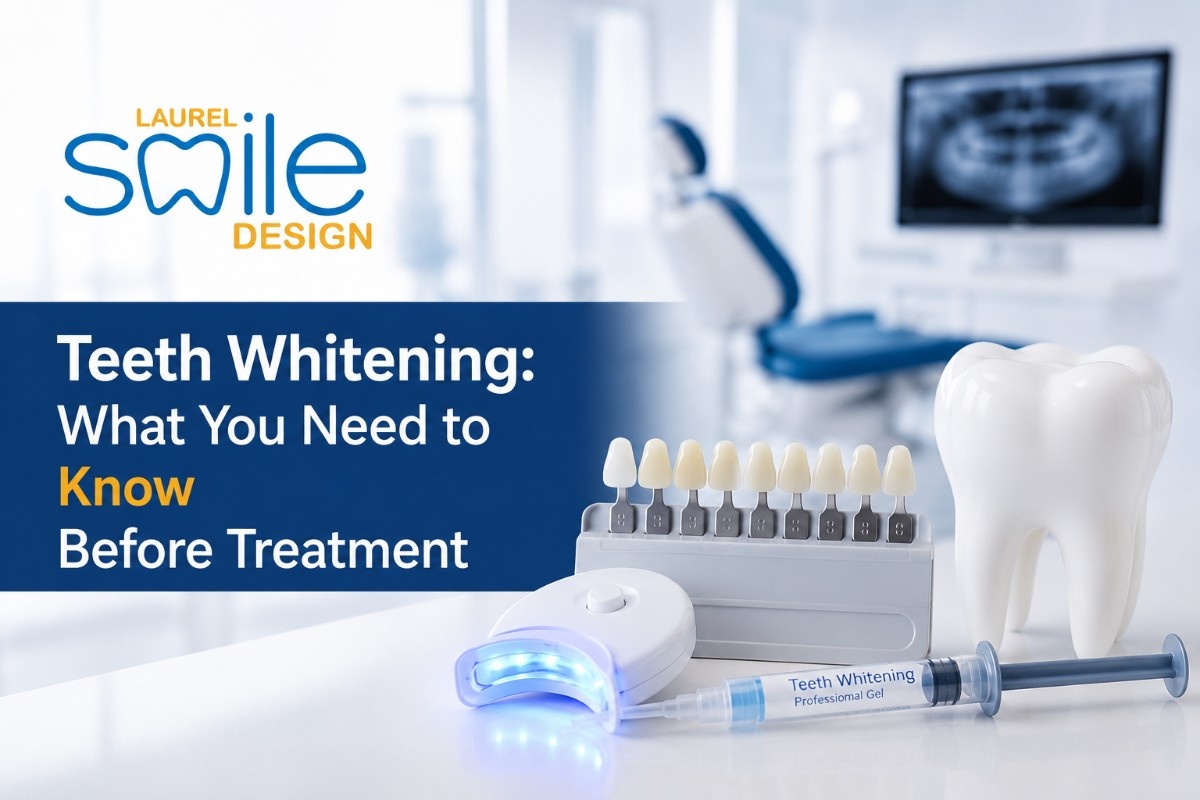 Teeth Whitening: What You Need to Know Before Treatment  
