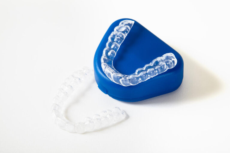 Invisalign treatment in laurel md