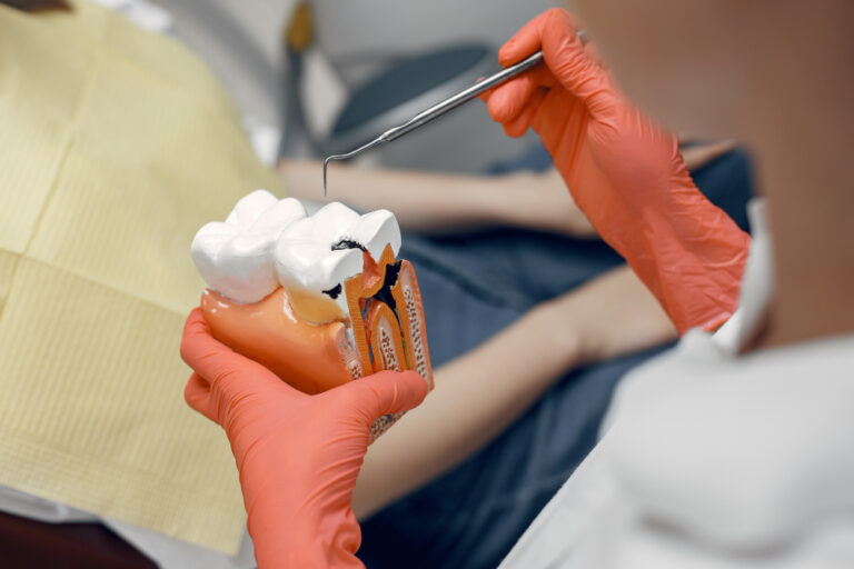 Root Canal treatment in laurel md